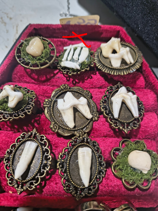 Adjustable teeth rings