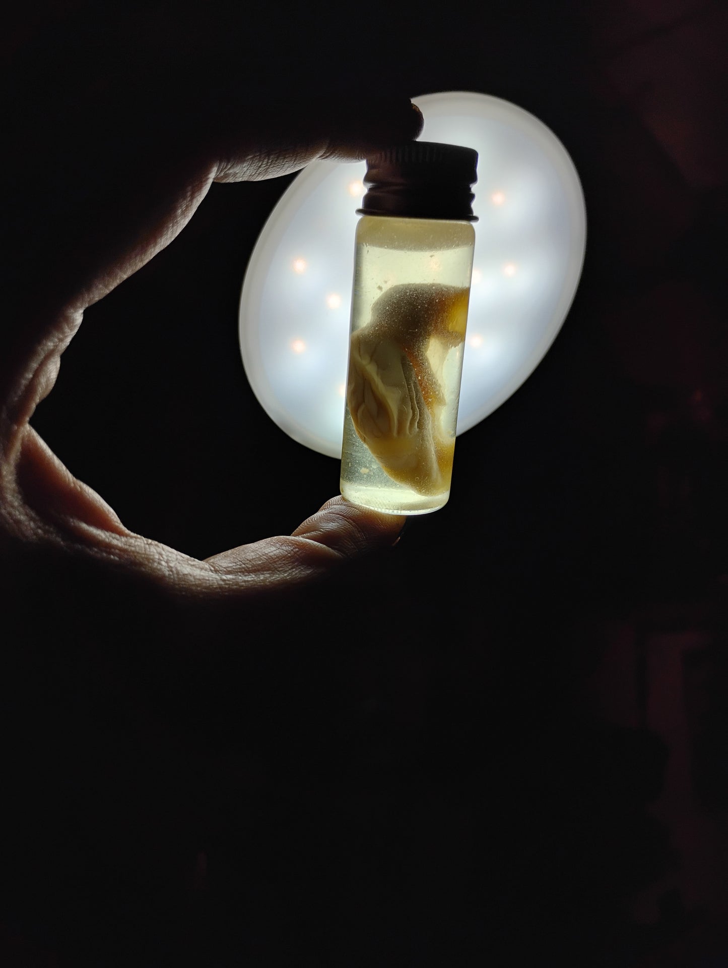 Mystery liver